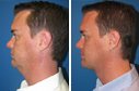 Before & After Photos
